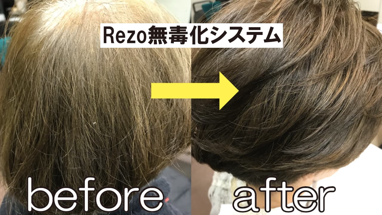レゾシステム